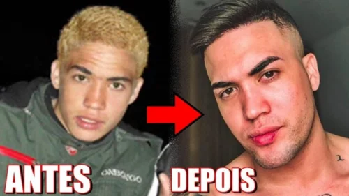 MC Brisola faz harmonização 