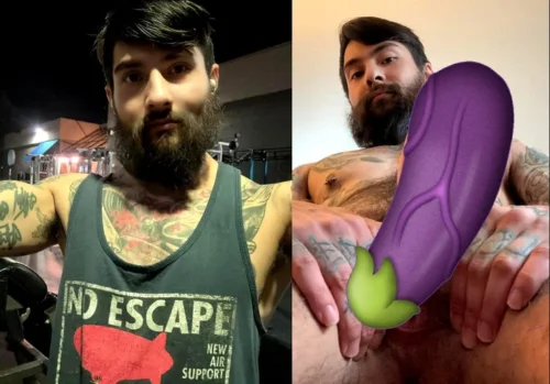 Homem Trans com Pênis Implant